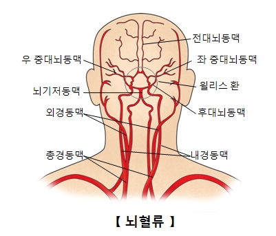 락트-인 증후군